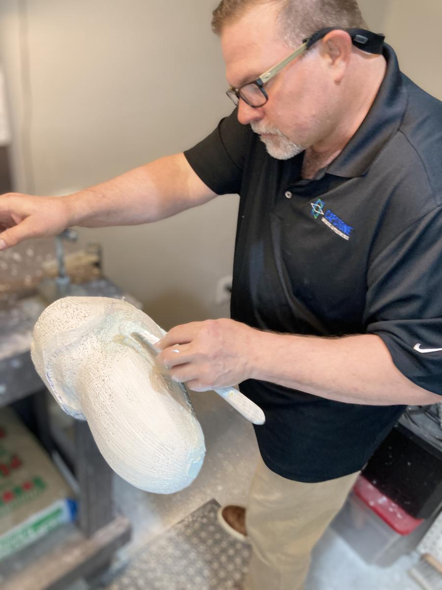 Male clinician modifying a plaster above knee prosthetic mold and adding plaster build ups to the model