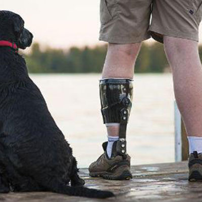 Image of man wearing orthosis standing by his dog