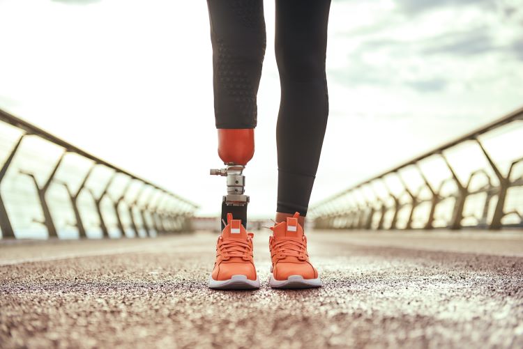 Woman running with prosthetic leg