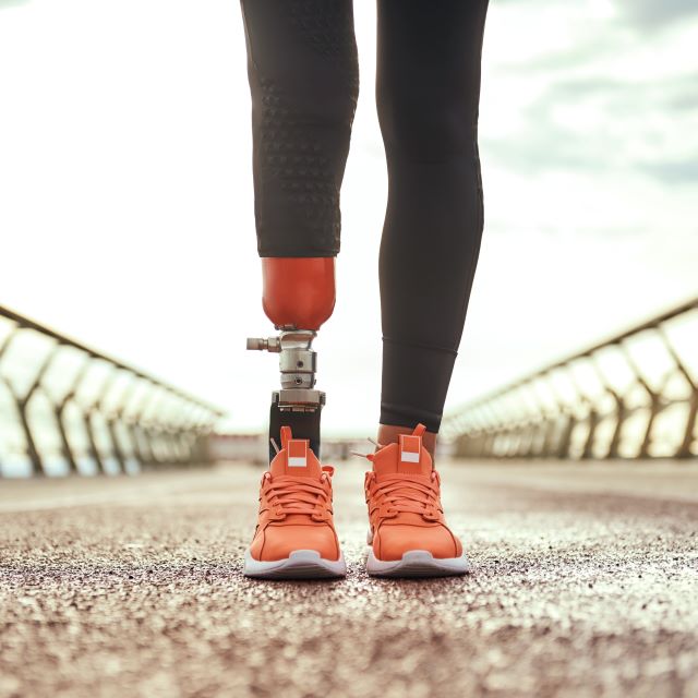 Picture of woman's legs standing on a bridge with an orange below knee prosthesis and matching orange shoes
